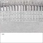 Garden Rocking Armchair Massiver und gepolsterter Stoff - Smart von Varaschin Viadurini